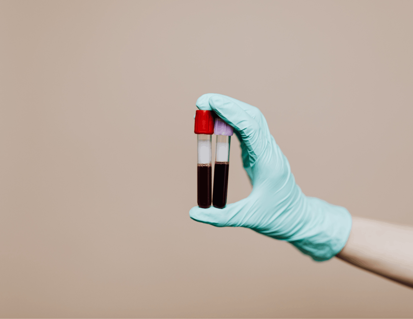 Two blood collection tubes with red caps used for iron panel testing in pregnancy, including ferritin, haemoglobin and transferrin markers