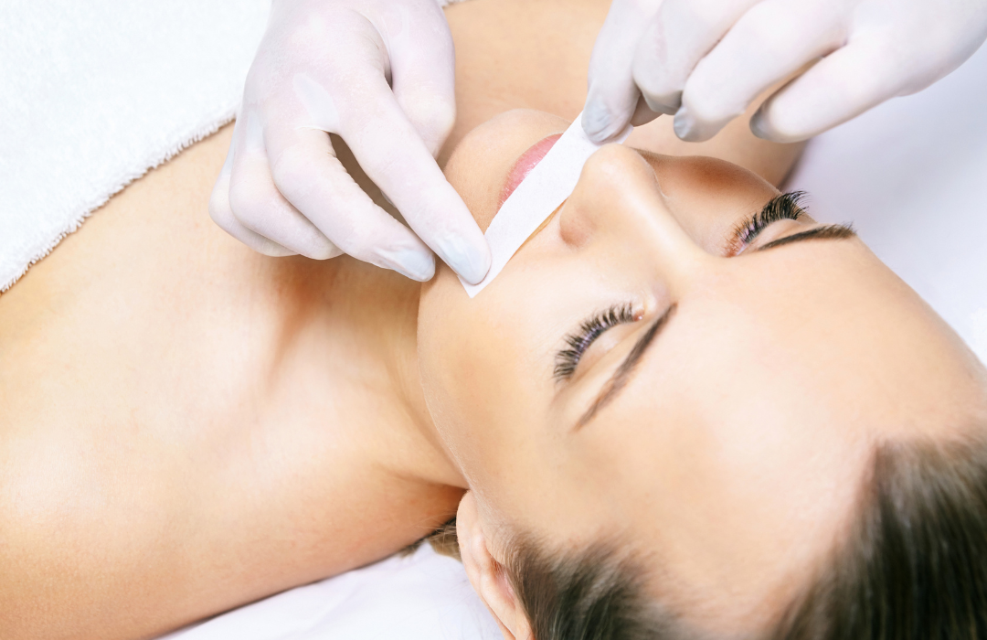 Hair Removal Options for PCOS: What You Need to Know